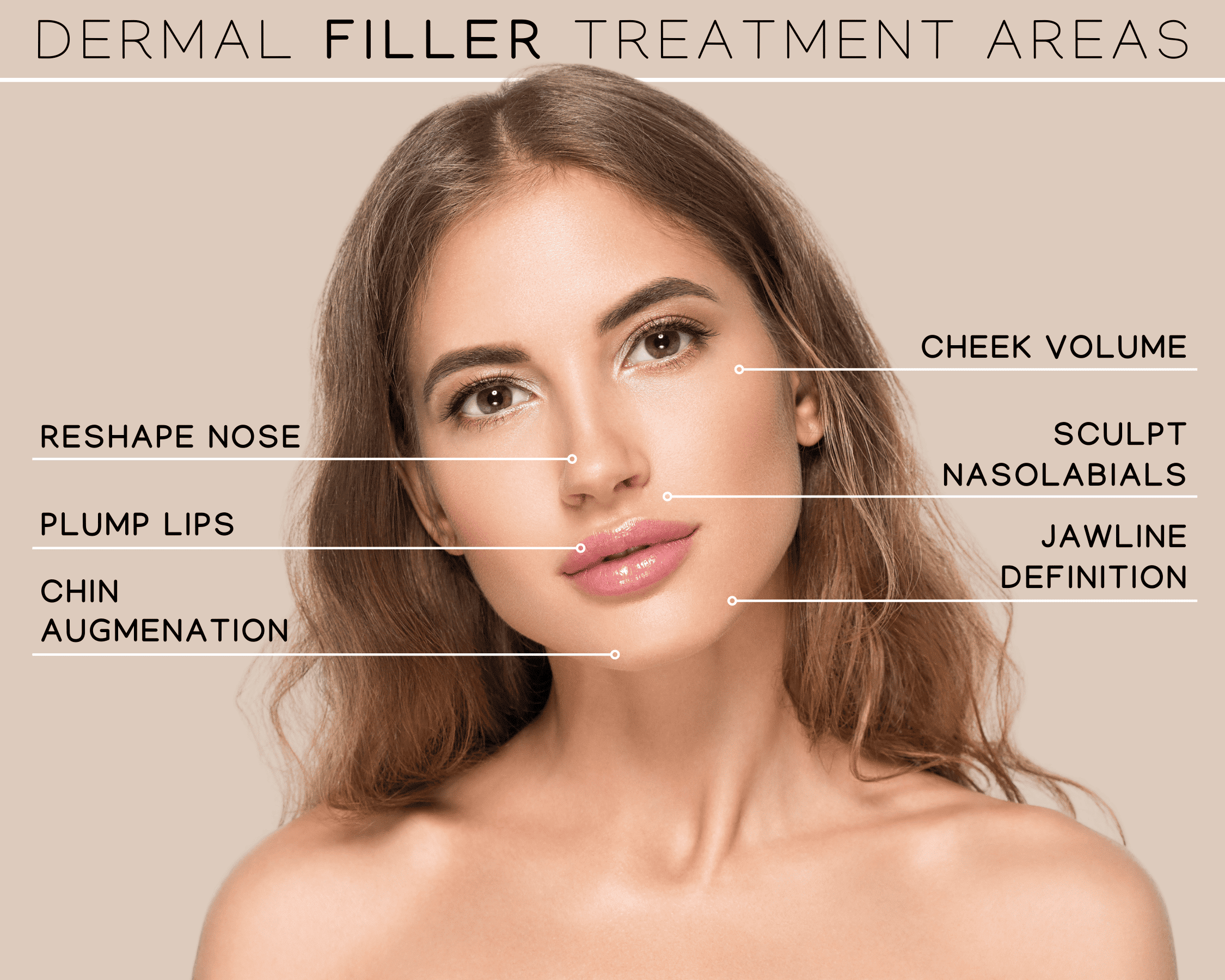 dermal filler