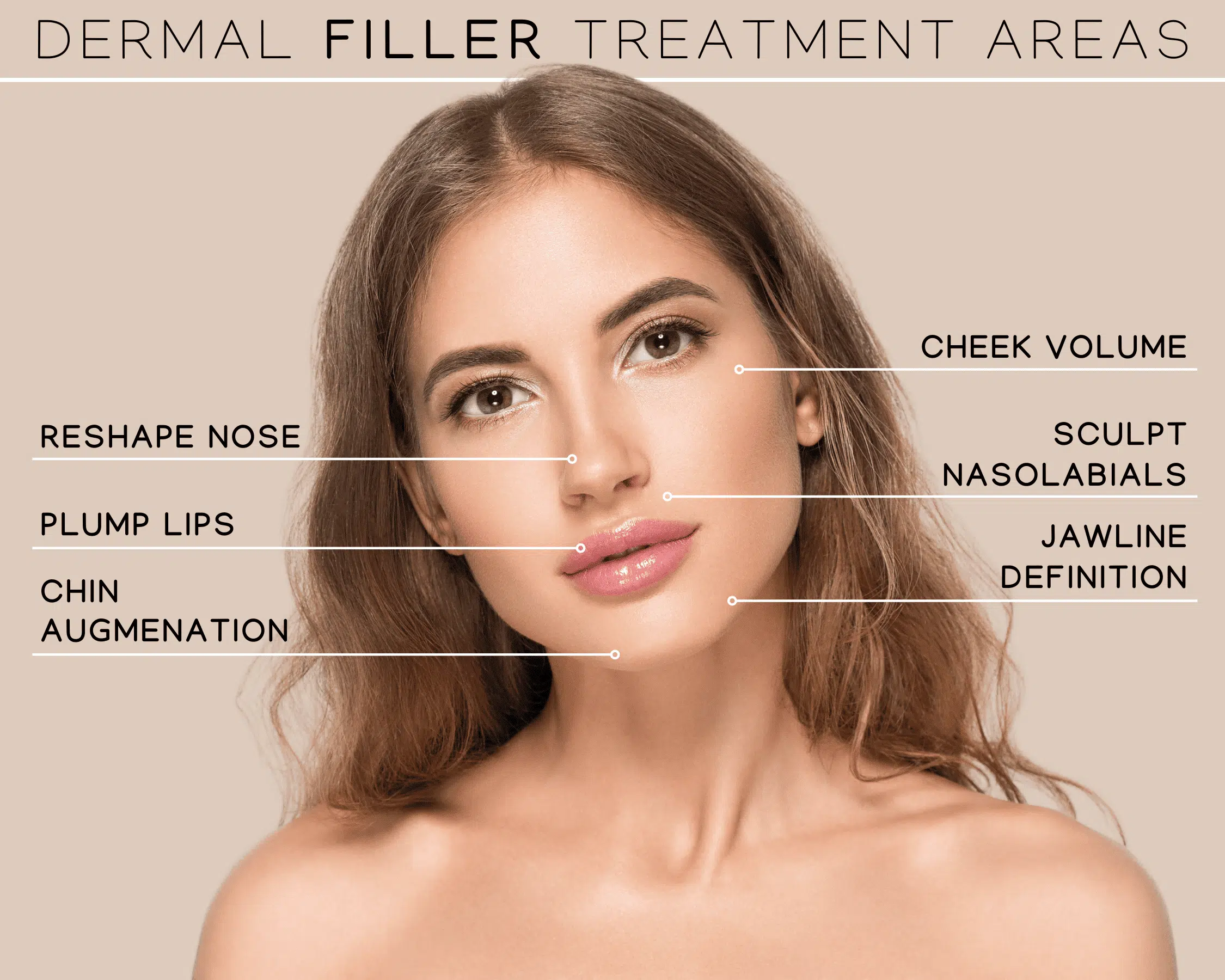 Beautiful woman with smooth, plump skin modeling the dermal filler treatment areas at Revenge MD in Las Vegas and Reno.