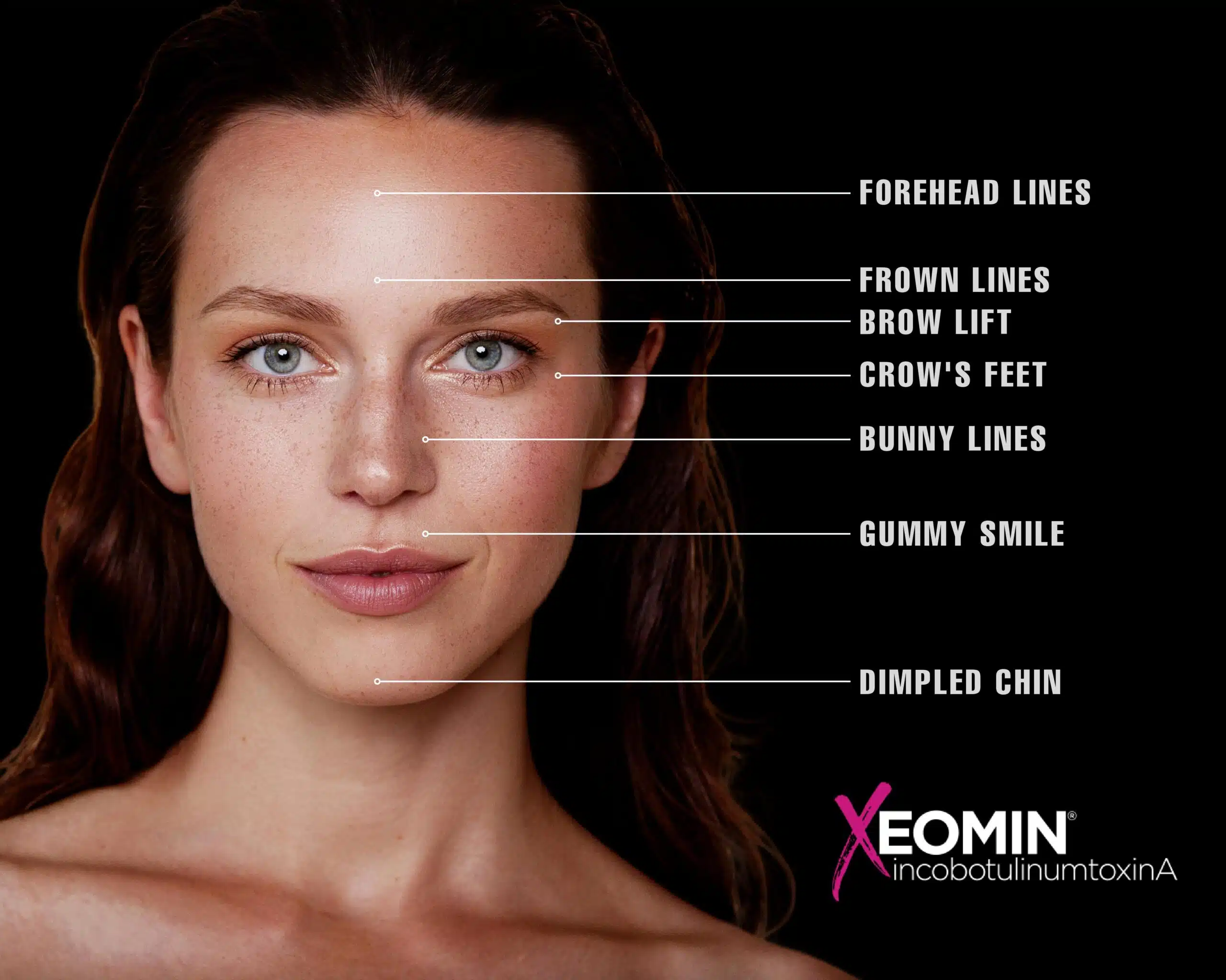 Xeomin Las Vegas Reno NV