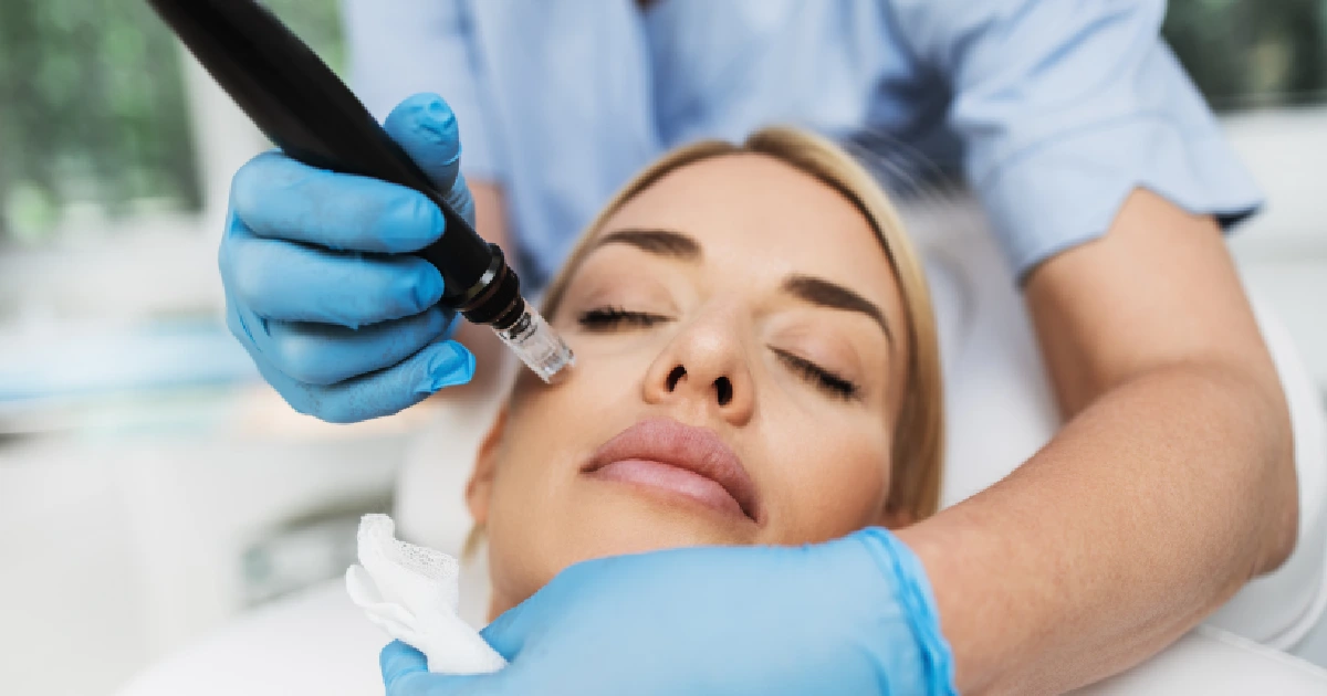 A women Receiving Microneedling in  Las Vegas, NV