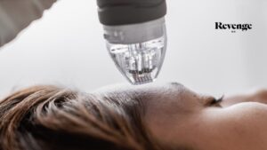 Microneedling in Las Vegas & Reno , NV