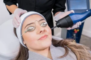 CO2 Laser for Deep Wrinkles and Sun Damage: Does It Really Work?