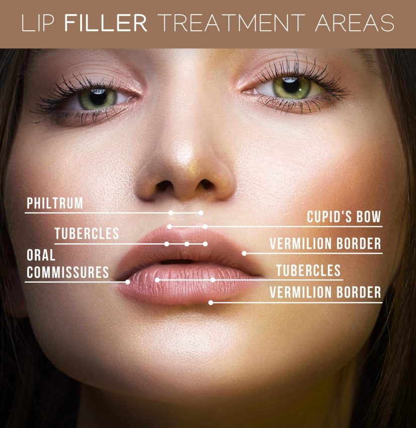 Beautiful woman with full lips modeling the various lip filler treatment areas for patients at Revenge MD.